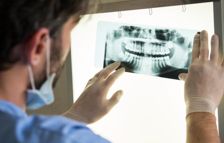 Dentist looking at a dental x-ray